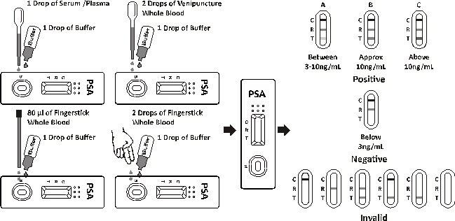 prostatitis psa elevation